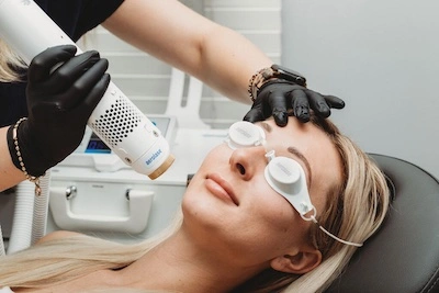 Aerolase Laser Treatments