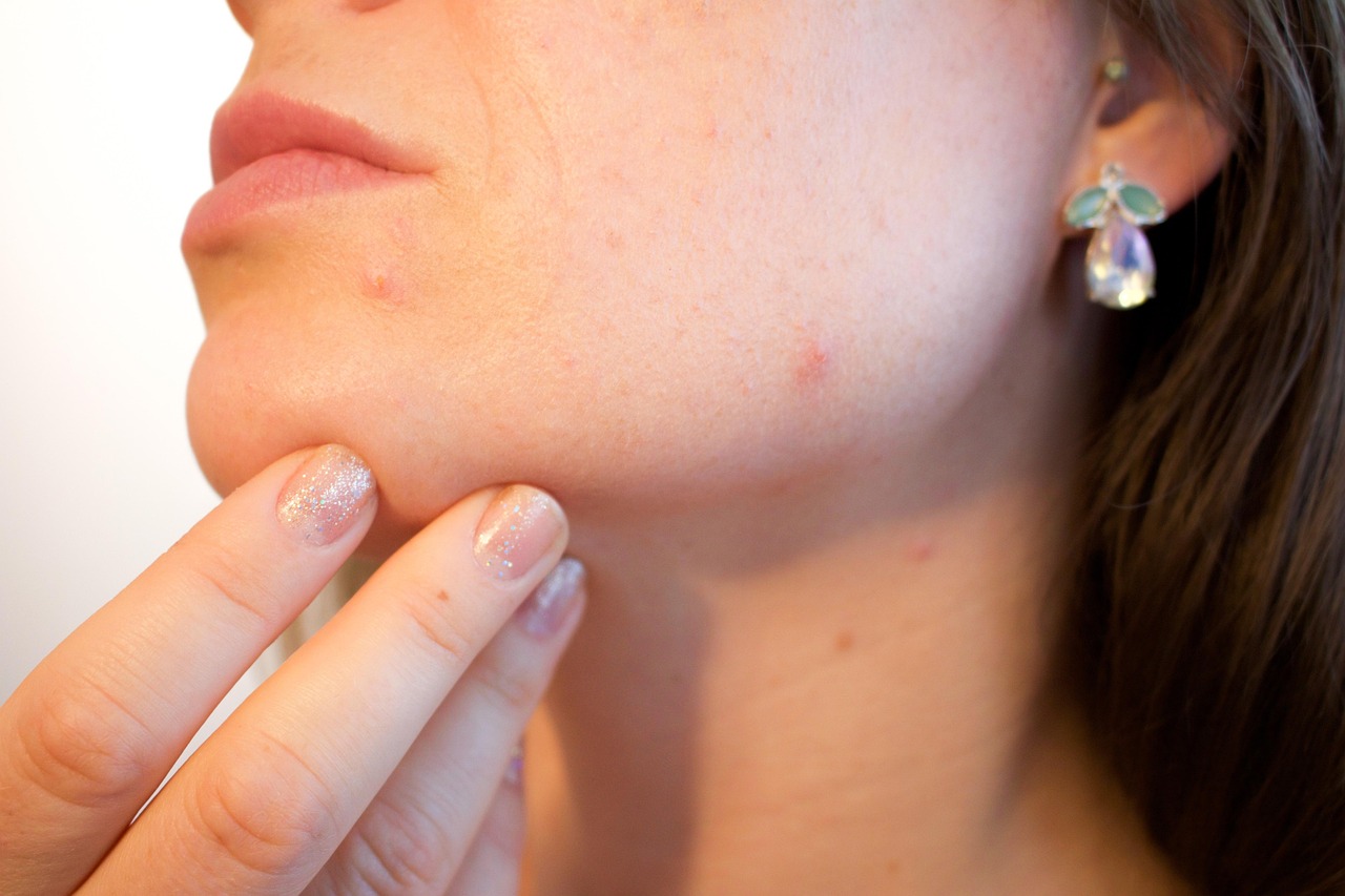 Extraction and decongestion facial in Toronto for clogged pores and acne-prone skin