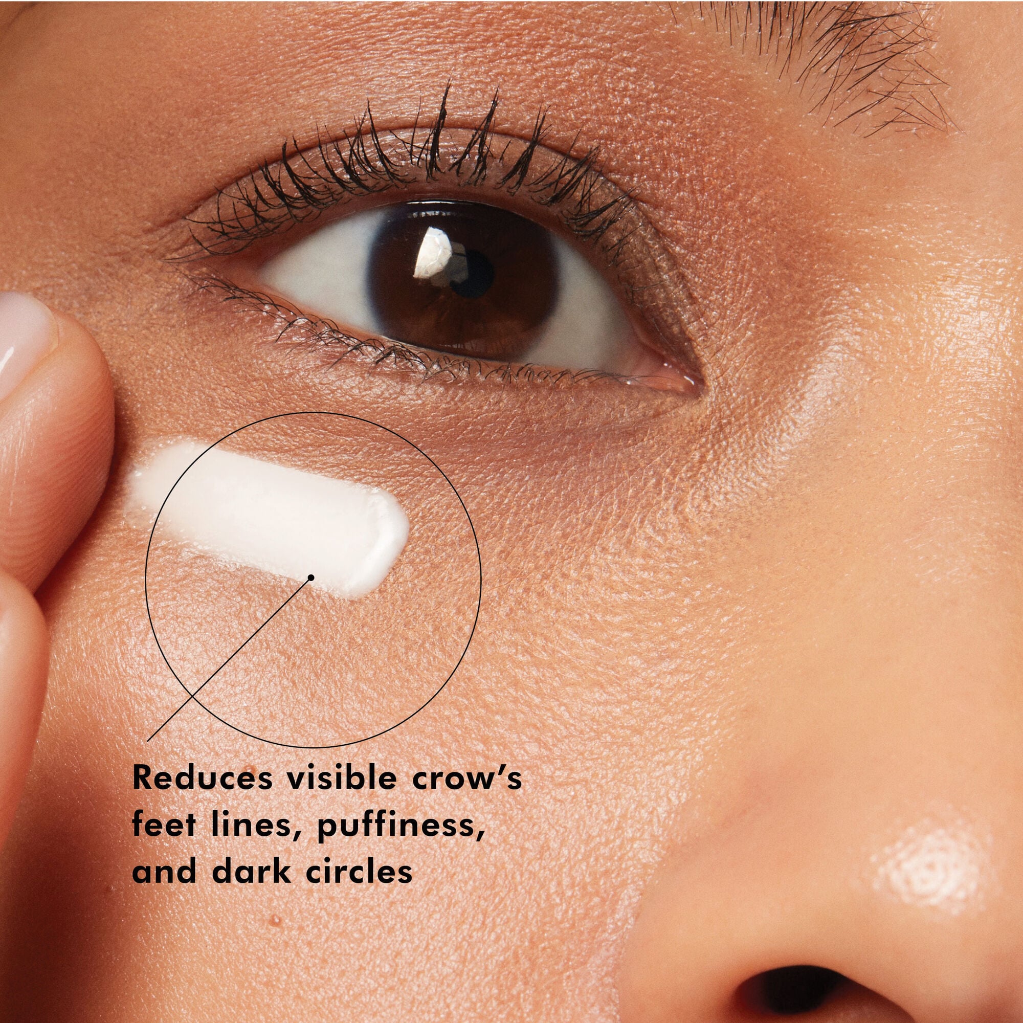 A.G.E Advanced Eye 15ml – product photo
