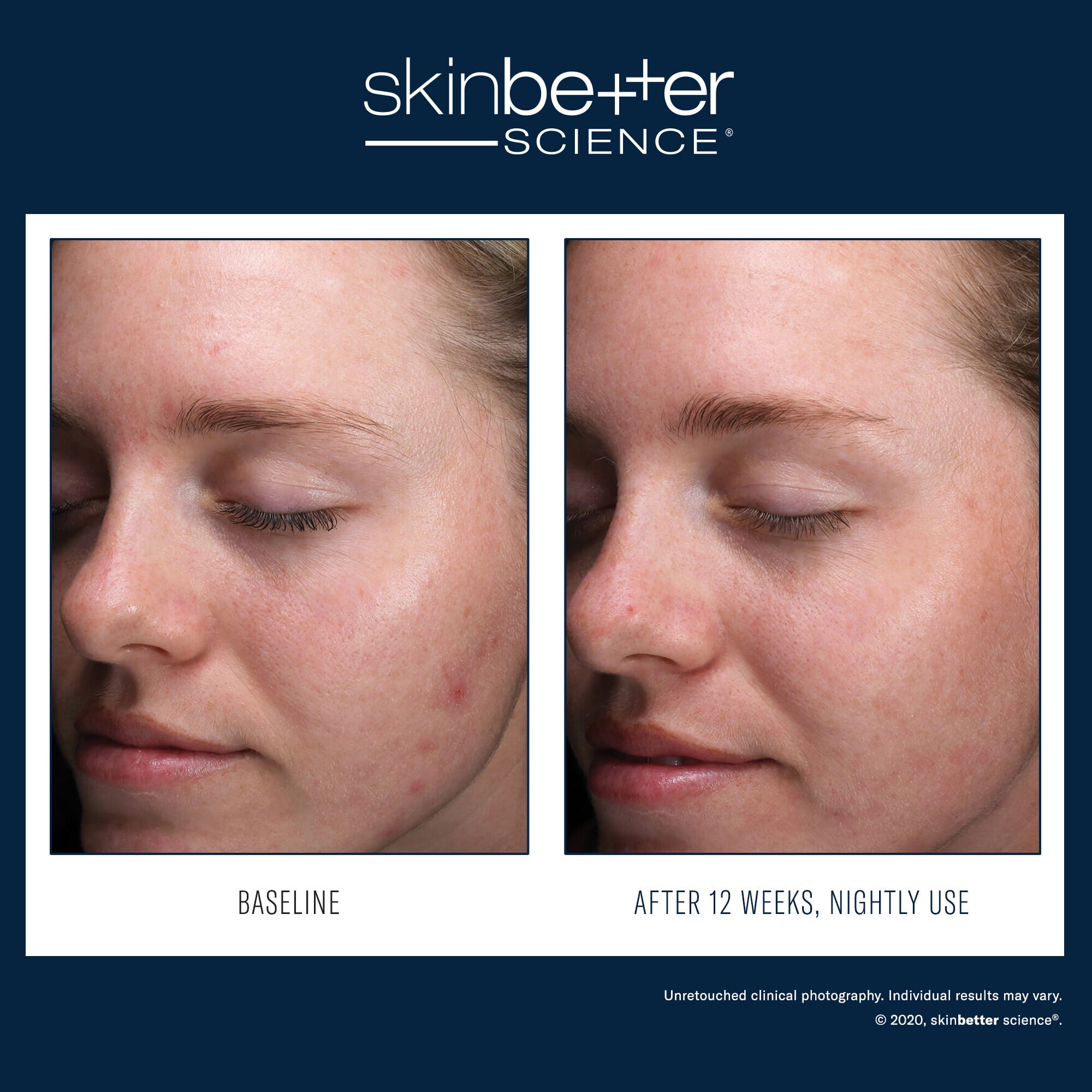 SkinBetter Science AlphaRet Clearing Serum – product photo