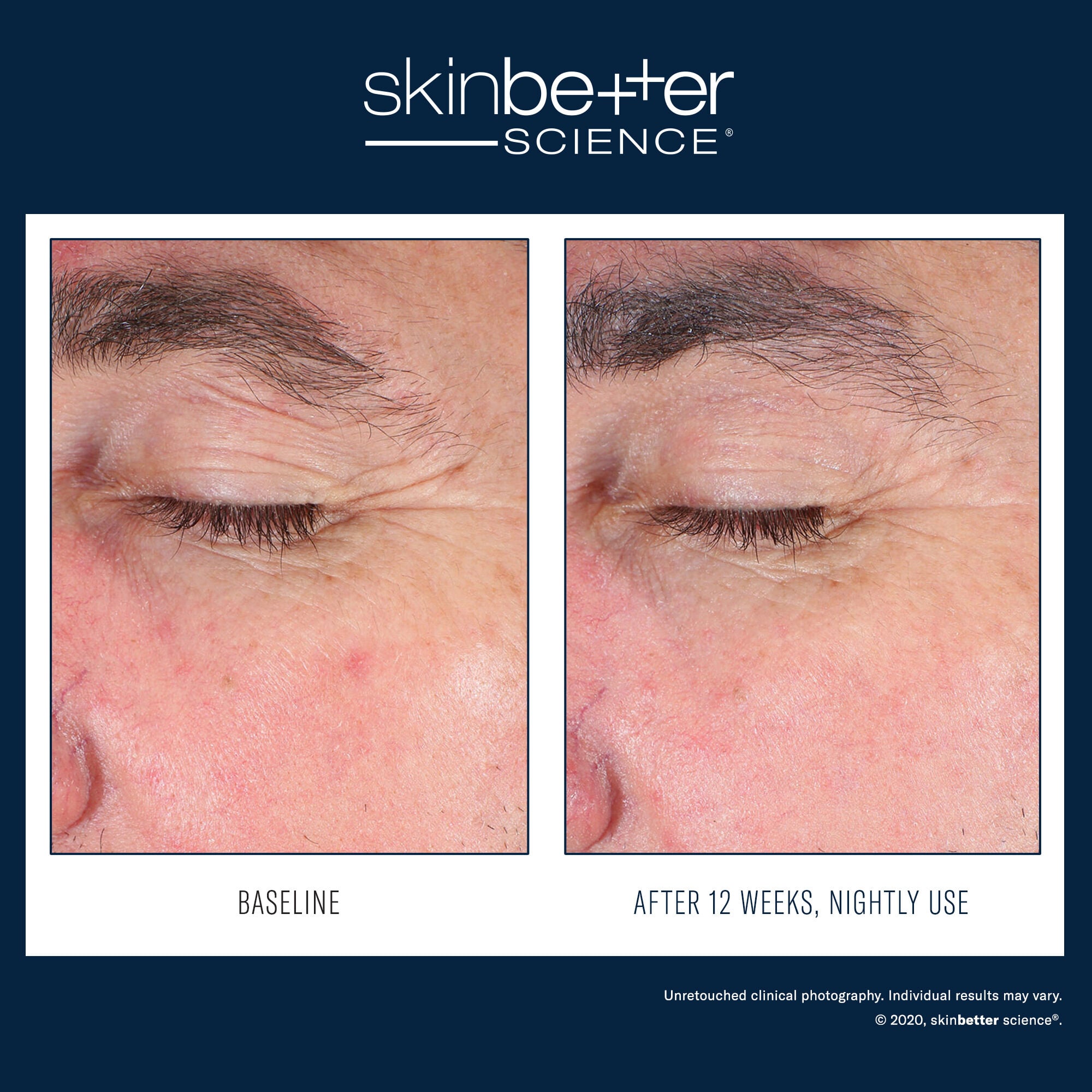 SkinBetter Science EyeMax AlphaRet Overnight Cream – product photo