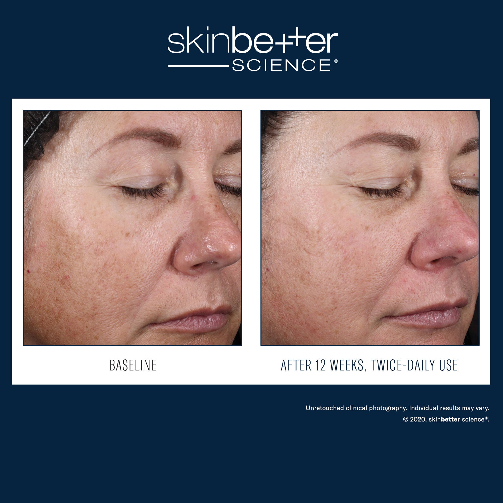 SkinBetter Science Alto Advanced Defense and Repair Serum – product photo