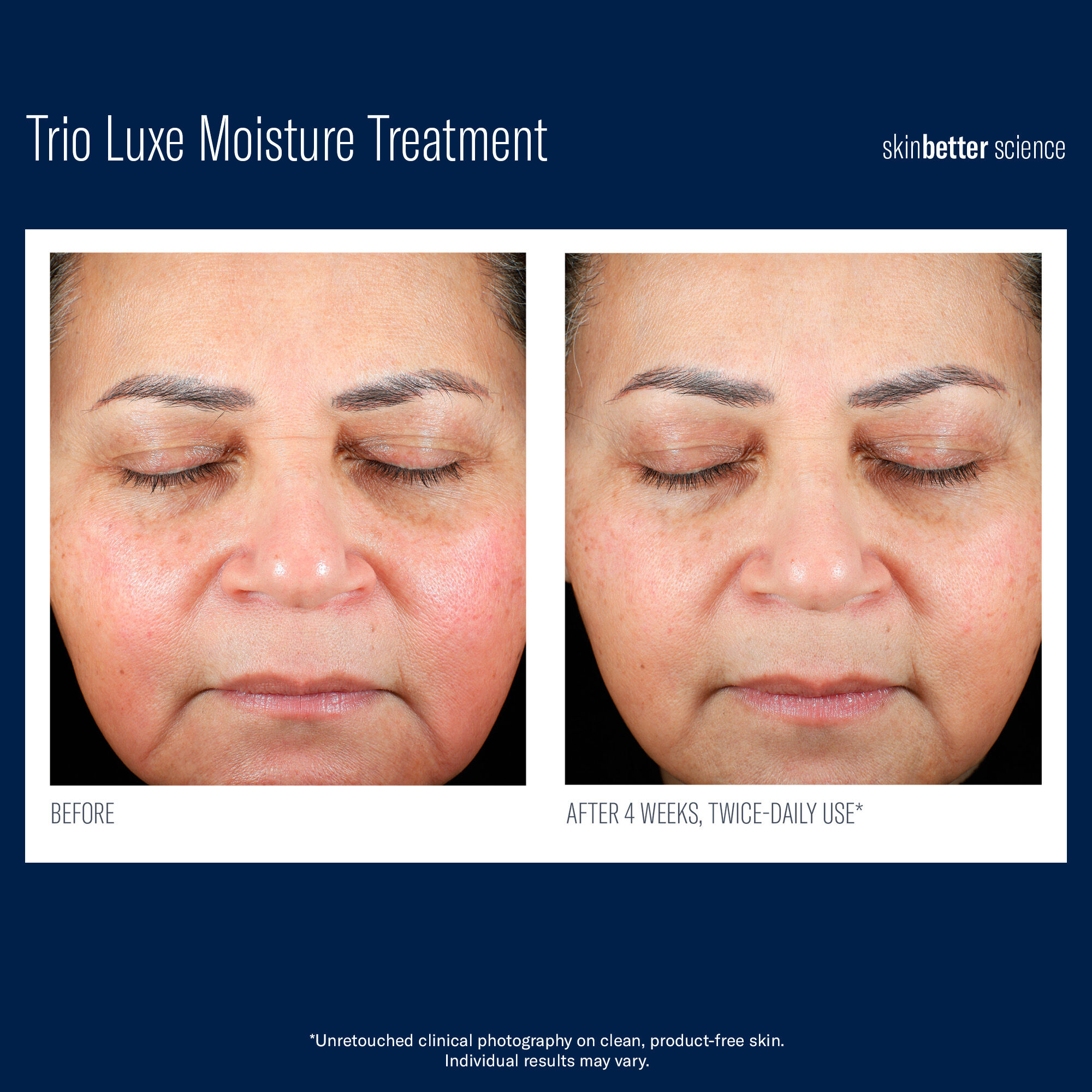 SkinBetter Science Trio Luxe Moisture Treatment – product photo
