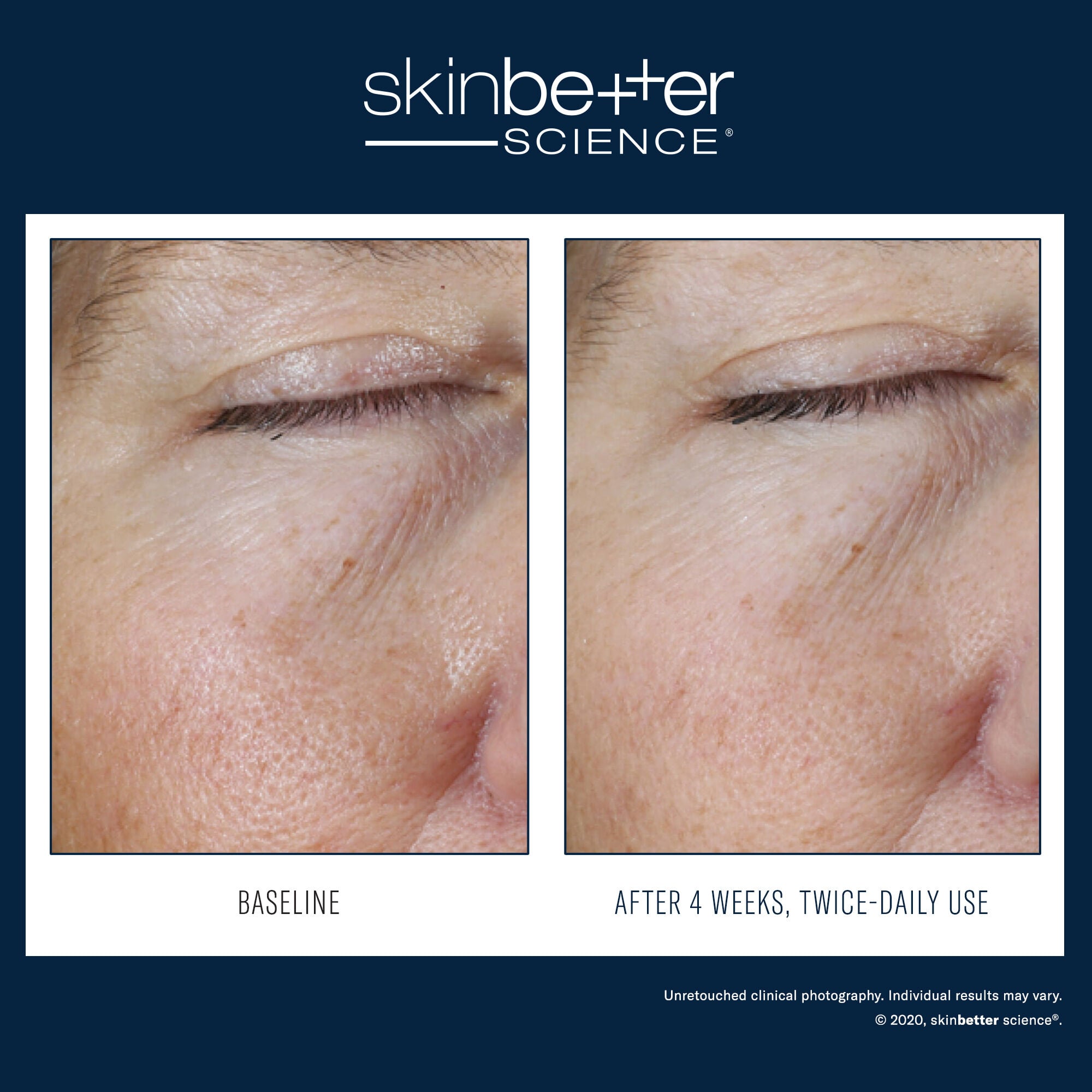 SkinBetter Science Instant Effect Gel EYE – product photo