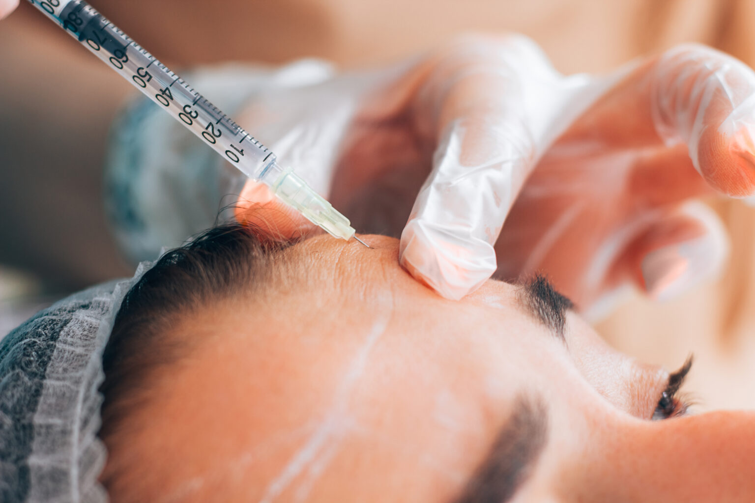 Best Botox clinics in Toronto compared, Bar Beauty Medical CityPlace