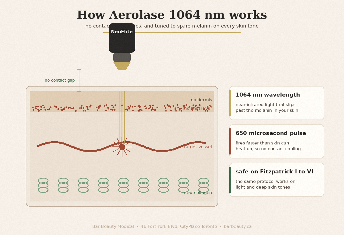 How Aerolase 1064nm laser works, no contact and safe on all skin tones | Bar Beauty Medical