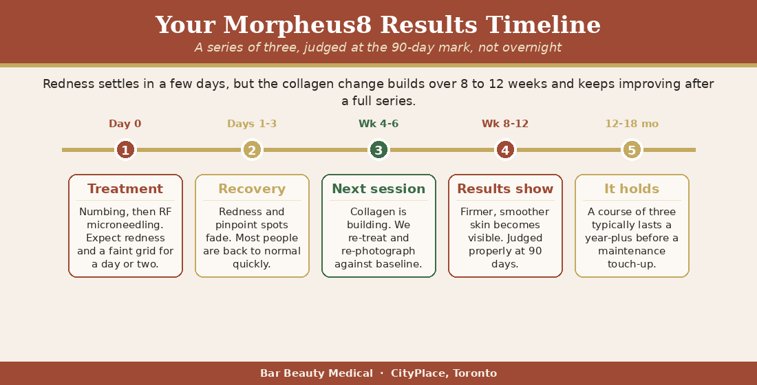Morpheus8 results timeline from treatment to 8 to 12 weeks | Bar Beauty Medical
