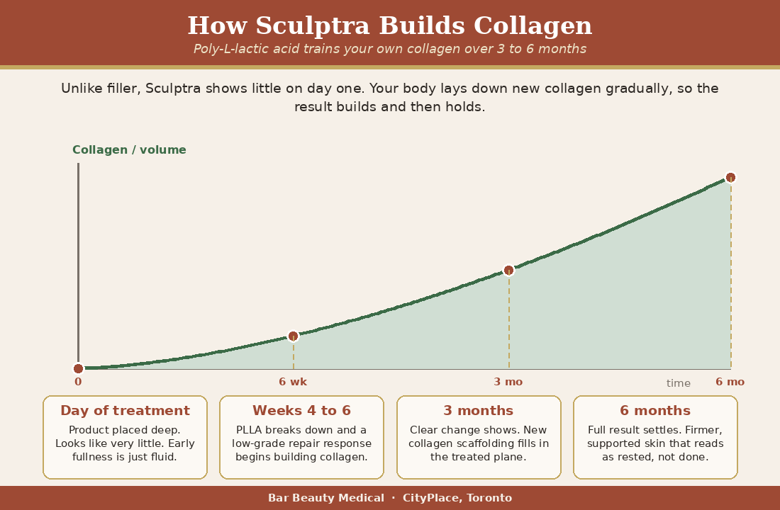 How Sculptra builds collagen over 3 to 6 months, a timeline | Bar Beauty Medical