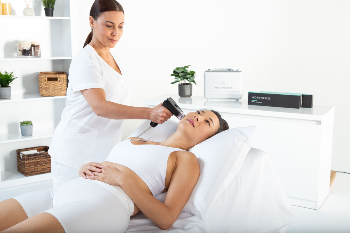 Morpheus8 radiofrequency microneedling treatment