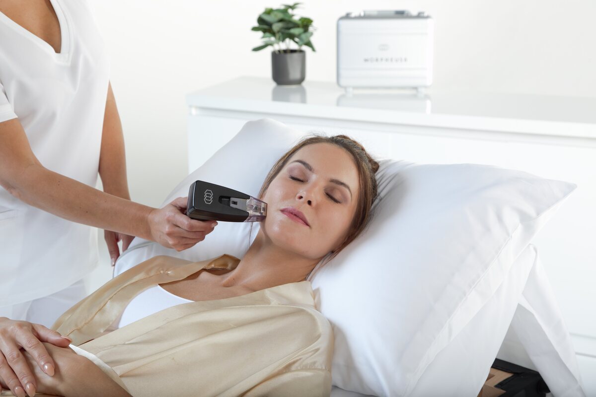 Morpheus8 radiofrequency microneedling treatment