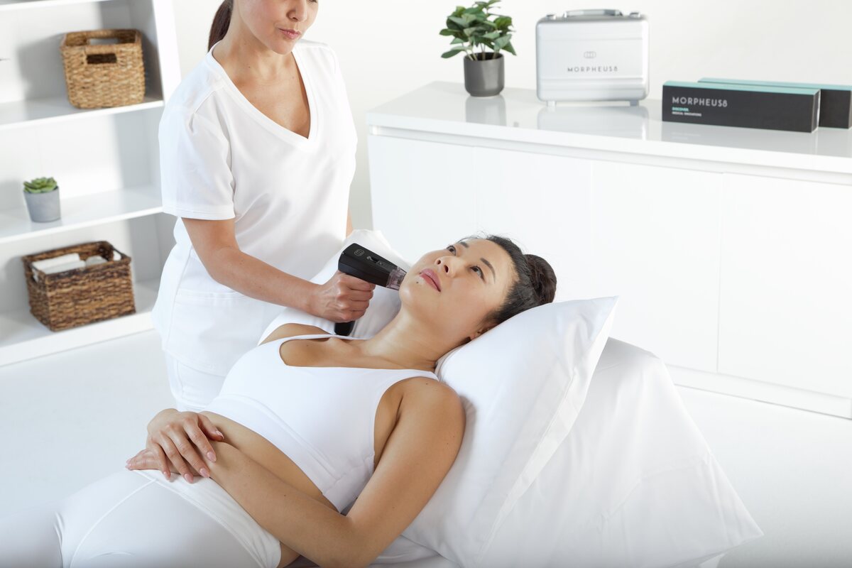 Morpheus8 radiofrequency microneedling treatment
