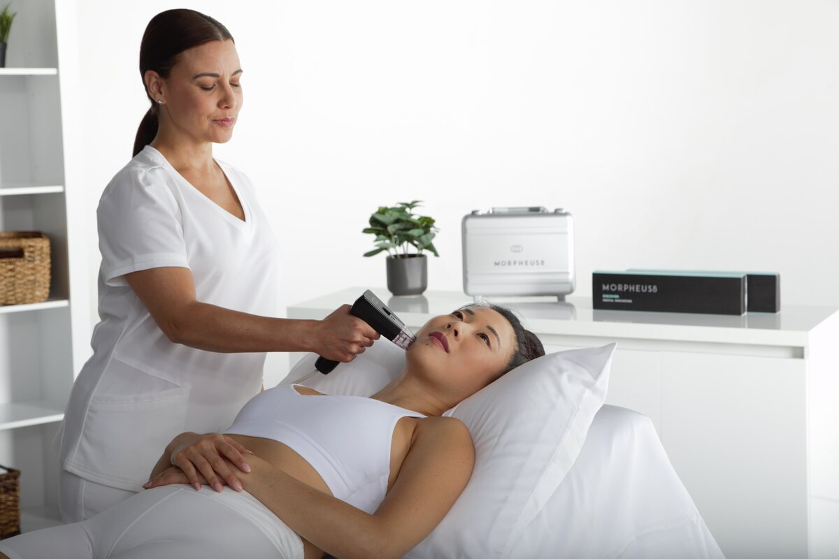Morpheus8 radiofrequency microneedling treatment