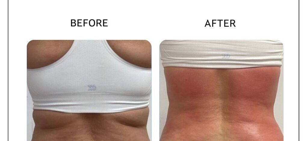 Venus Bliss before and after result