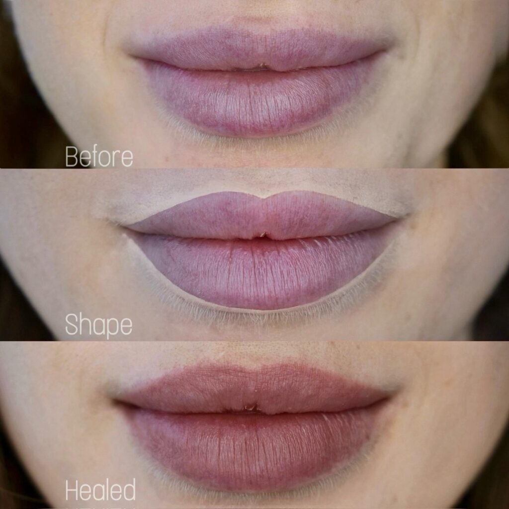 Lip blush before and after in Toronto, healed result by Amber Stenson at Bar Beauty Medical