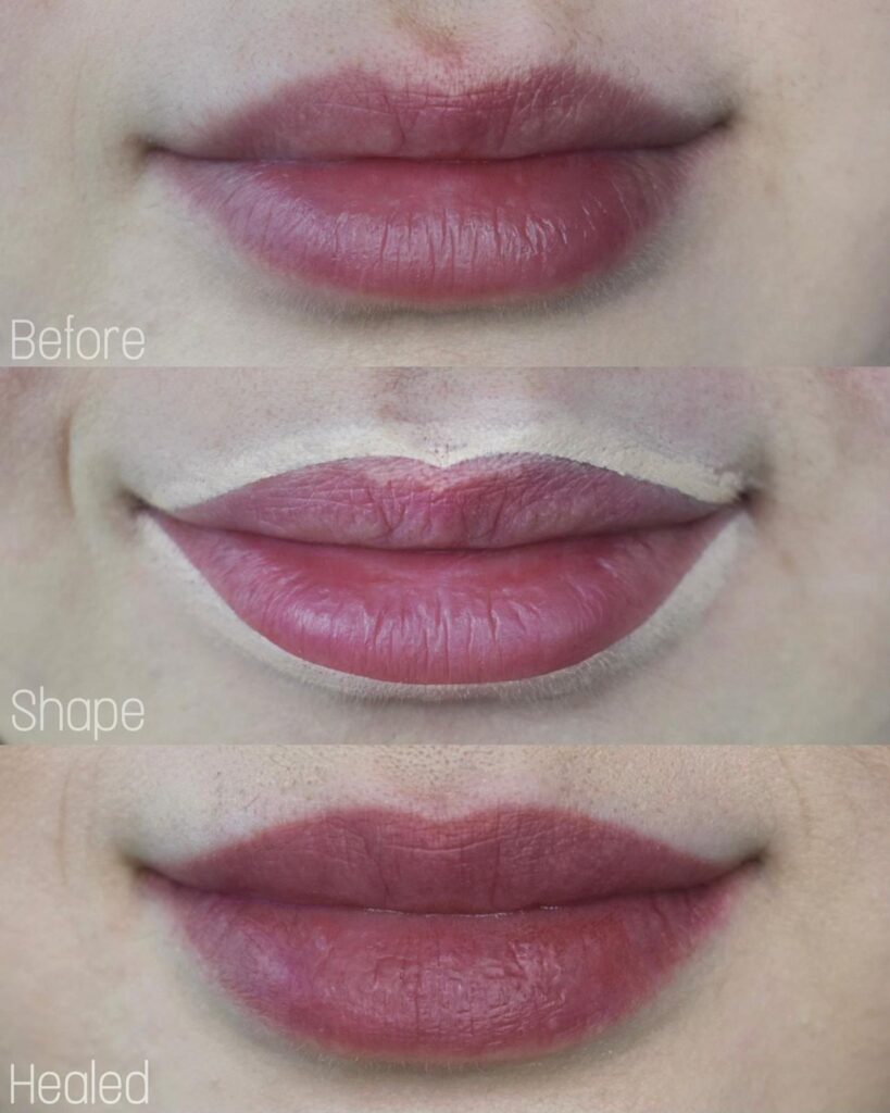 Lip blush before and after on mature skin, healed colour and definition, Toronto
