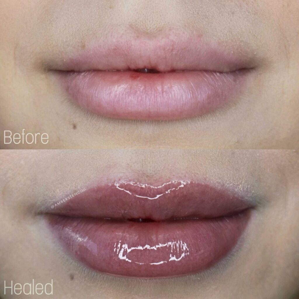 Lip blush before and after split image showing healed pigment, Bar Beauty Medical Toronto
