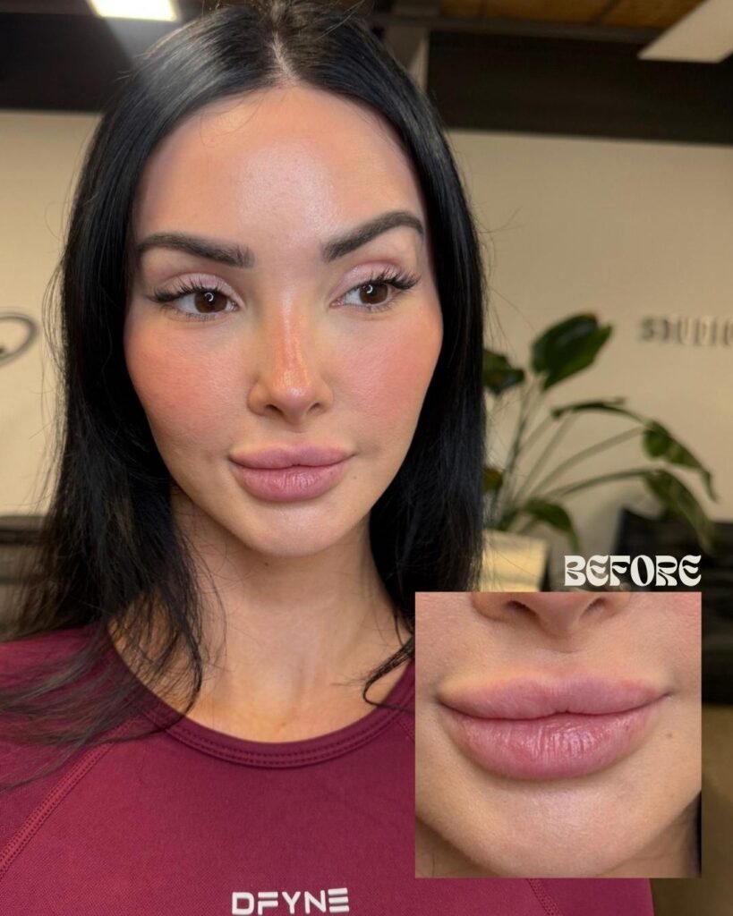 Fresh lip tint tattoo immediately after a lip blush session in Toronto