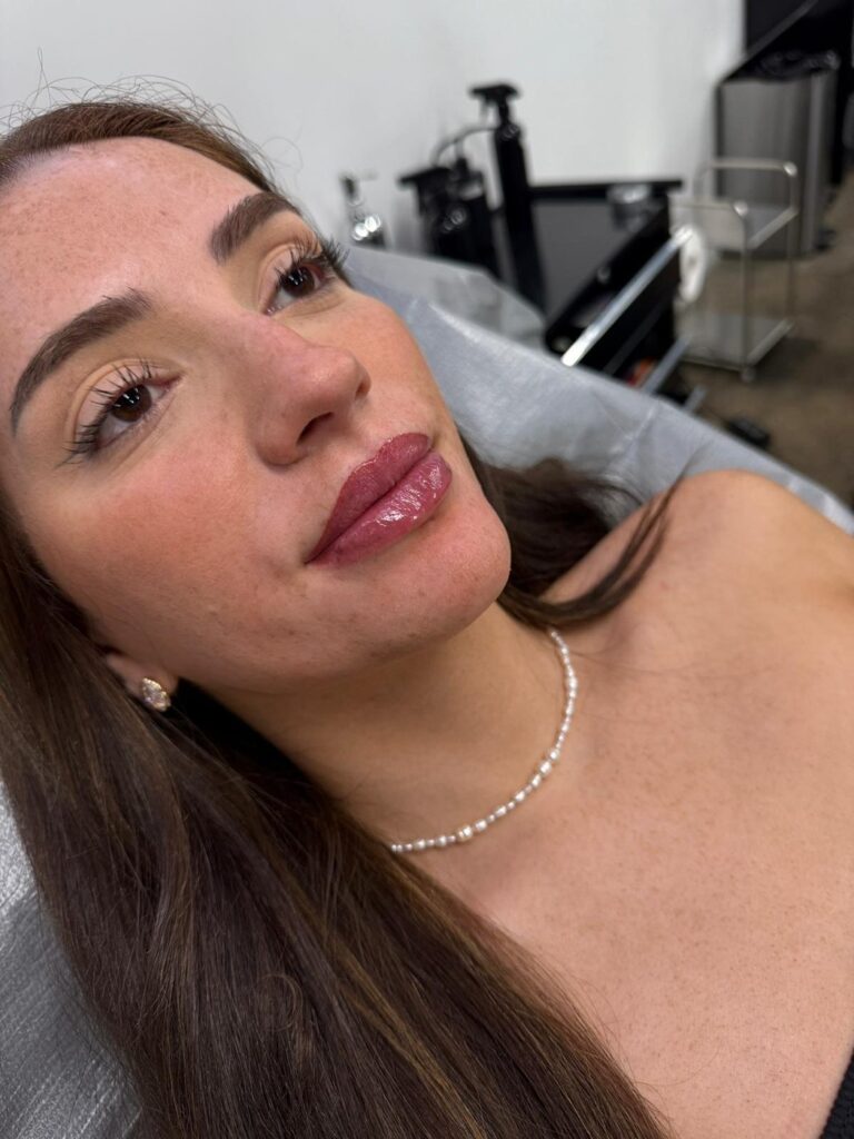 Lip blush before, shape mapping and healed result, three stage comparison, Toronto