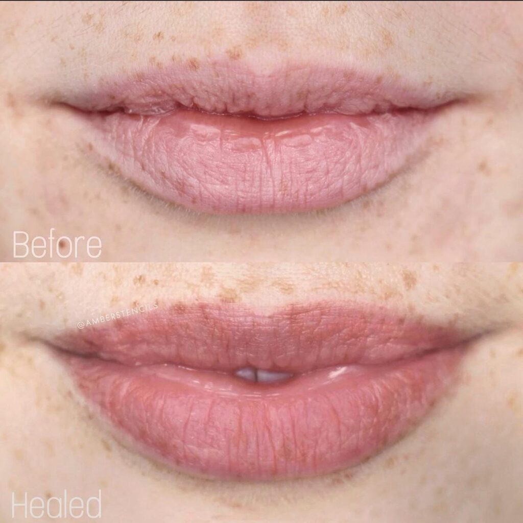 Lip micropigmentation before and after, healed lip blush colour, Bar Beauty Medical Toronto
