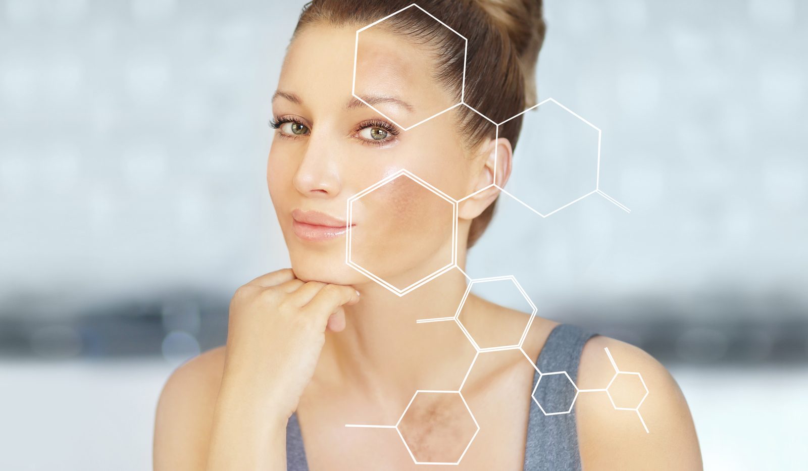 Hyperpigmentation and dark spots treated with Aerolase laser - Bar Beauty Toronto