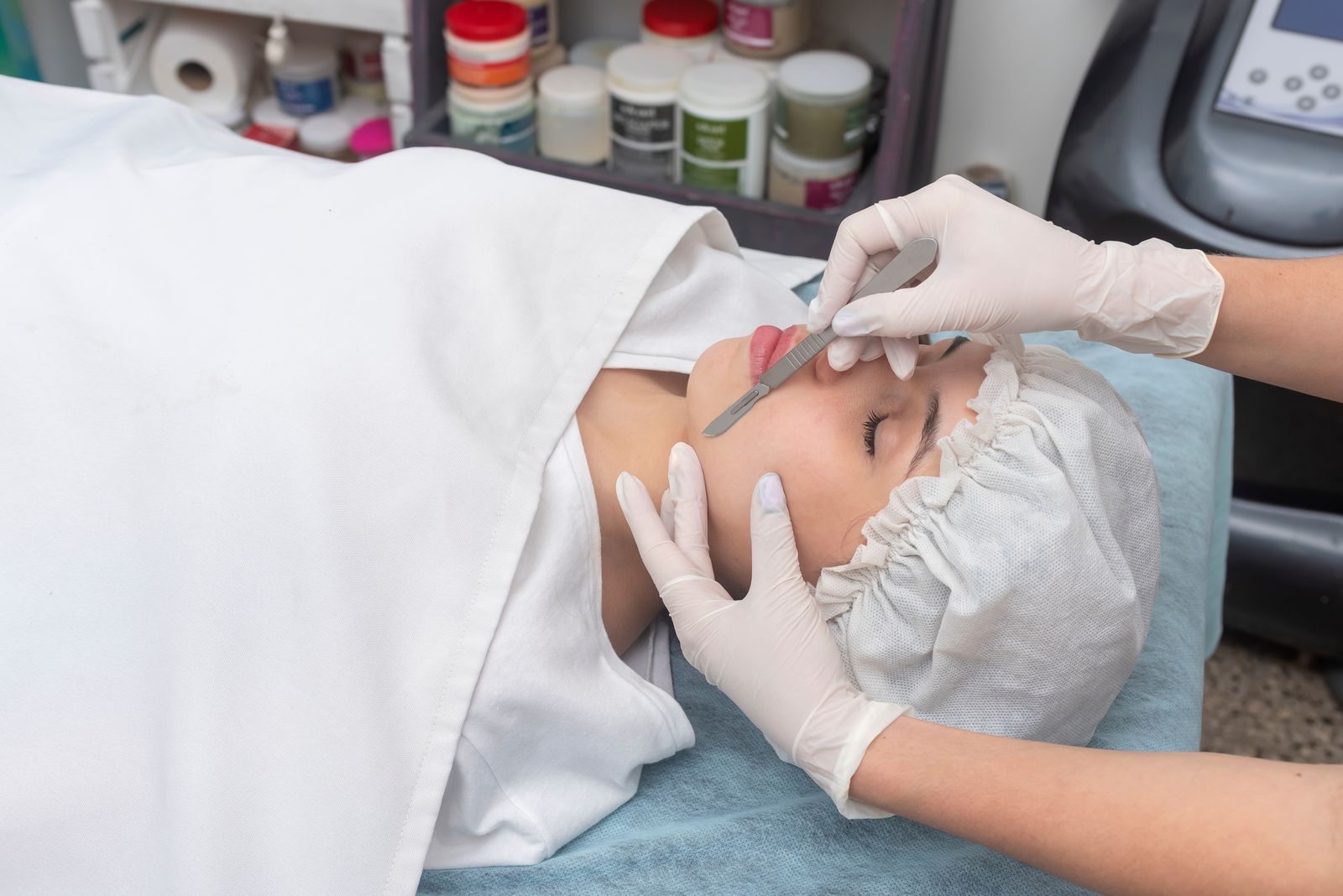 Skin treatment with dermaplaning technique - Bar Beauty Medical Toronto