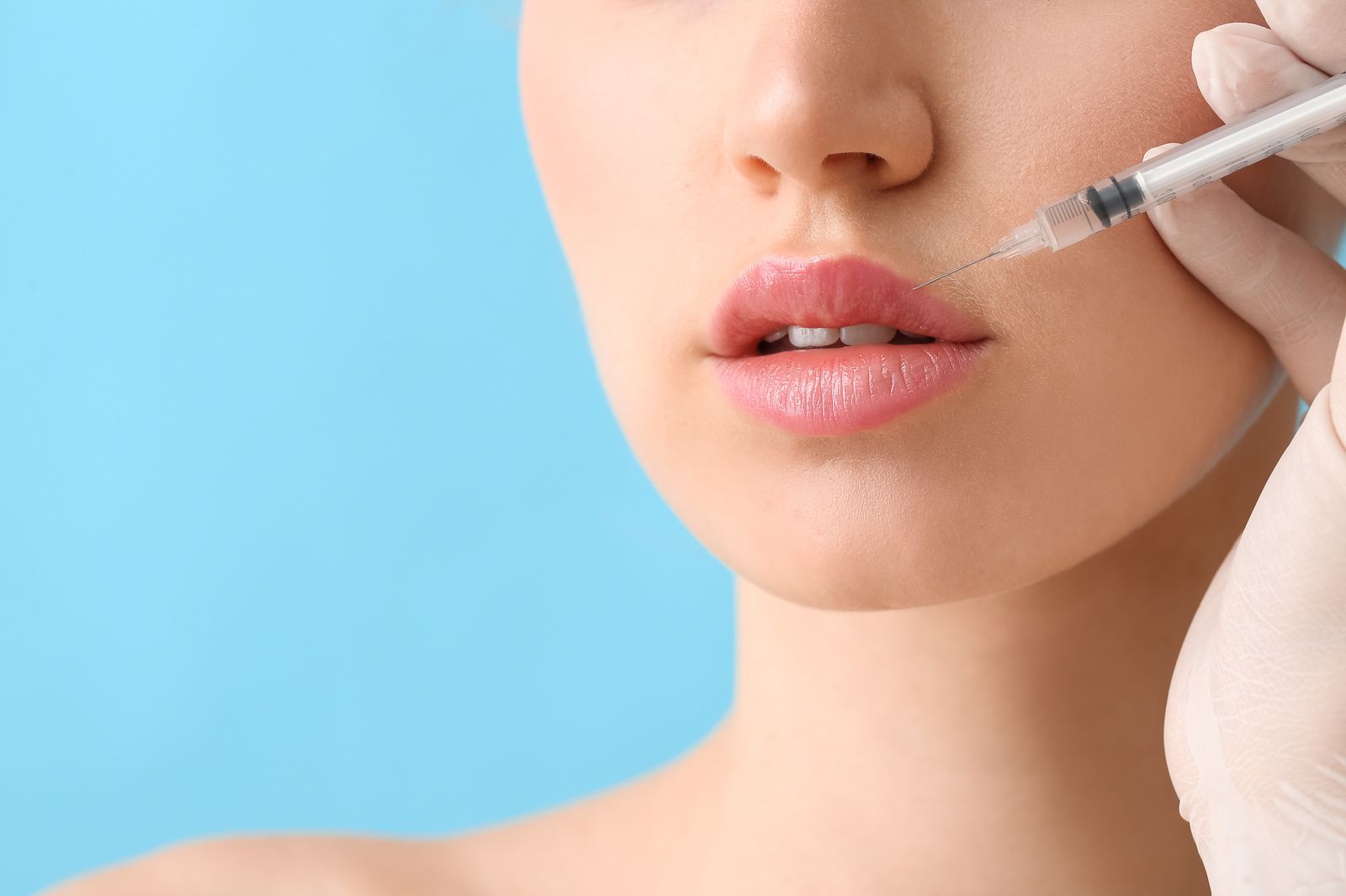 How long lip filler lasts - HA lip filler longevity timeline at Bar Beauty Medical, CityPlace Toronto
