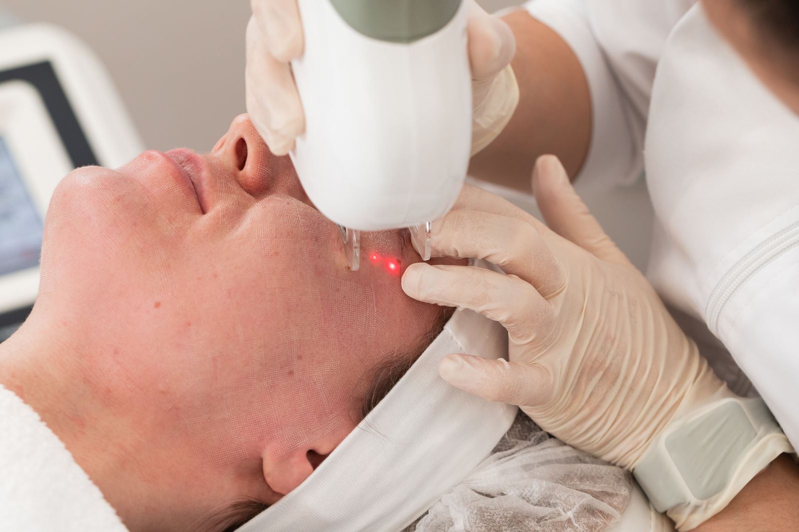 Aerolase NeoElite laser treatment room at Bar Beauty Medical, CityPlace Toronto