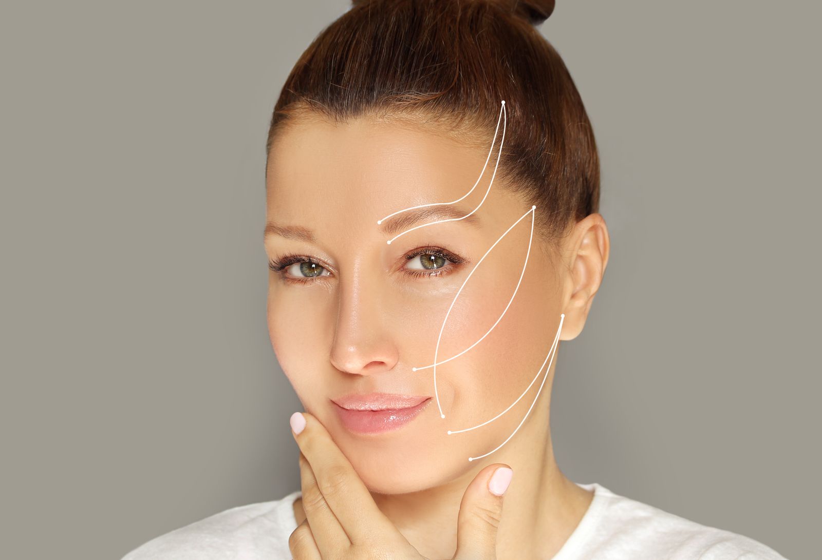 PDO thread lift markup before procedure - Bar Beauty Medical Toronto